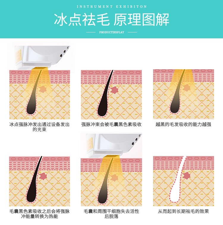 opt脱毛仪